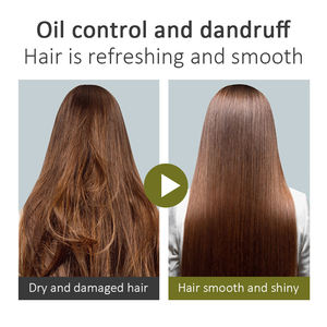 Bio-shampoing sur mesure à base de plantes pour hommes et femmes, <span class=keywords><strong>anti</strong></span>-<span class=keywords><strong>chute</strong></span>, logo personnalisé, huile naturelle, nettoyage écologique, perte de poids et soins de pellicules, ml, vente en gros - Product Image 4