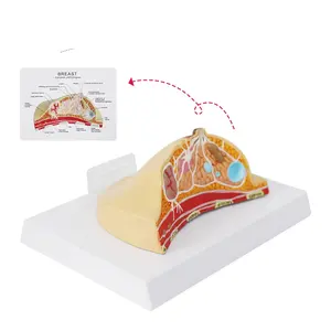 Modèle de structure anatomique pathologique du modèle de maladies mammaires courantes Modèle de sein pathologique humain