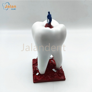 Alla moda sculture dentali regali da scrivania dentaria decorazione dentaria in resina scultura decorazione clinica odontoiatrica - Product Image 2