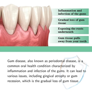 Mousse de 30 ml para Reparación Rápida de Caries, Limpia y Blanquea los <span class=keywords><strong>Dientes</strong></span>, Elimina las Manchas Amarillas de Placa, Gengivas Dañadas, Dolor de Muelas - Product Image 4
