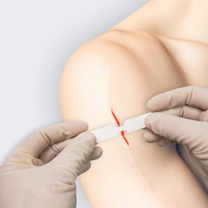 Bandes de fermeture cutanée renforcées de qualité médicale, stériles, Steri-Strips, pour la fermeture des plaies chirurgicales, points adhésifs papillon, bandage - Product Image 3