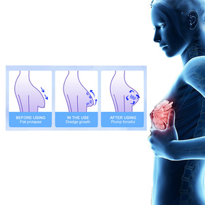 Dispositivo de Aumento de Senos, Tecnología de Liposucción por Presión Negativa, Masajeador de Doble Copa, Moldeador de Senos Caídos - Product Image 4