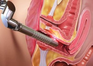 Dispositivo Portátil de Rejuvenecimiento y Tensado Vaginal con Terapia de <span class=keywords><strong>Luz</strong></span> Láser de Diodo de 980nm y 1470nm para Uso Comercial con Enfriamiento por Aire - Product Image 3