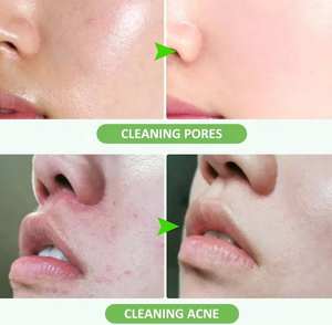 Masque à bulles d'oxygène 2 en 1 et mousse nettoyante <span class=keywords><strong>double</strong></span> <span class=keywords><strong>nettoyage</strong></span> pour hommes et femmes - Product Image 4