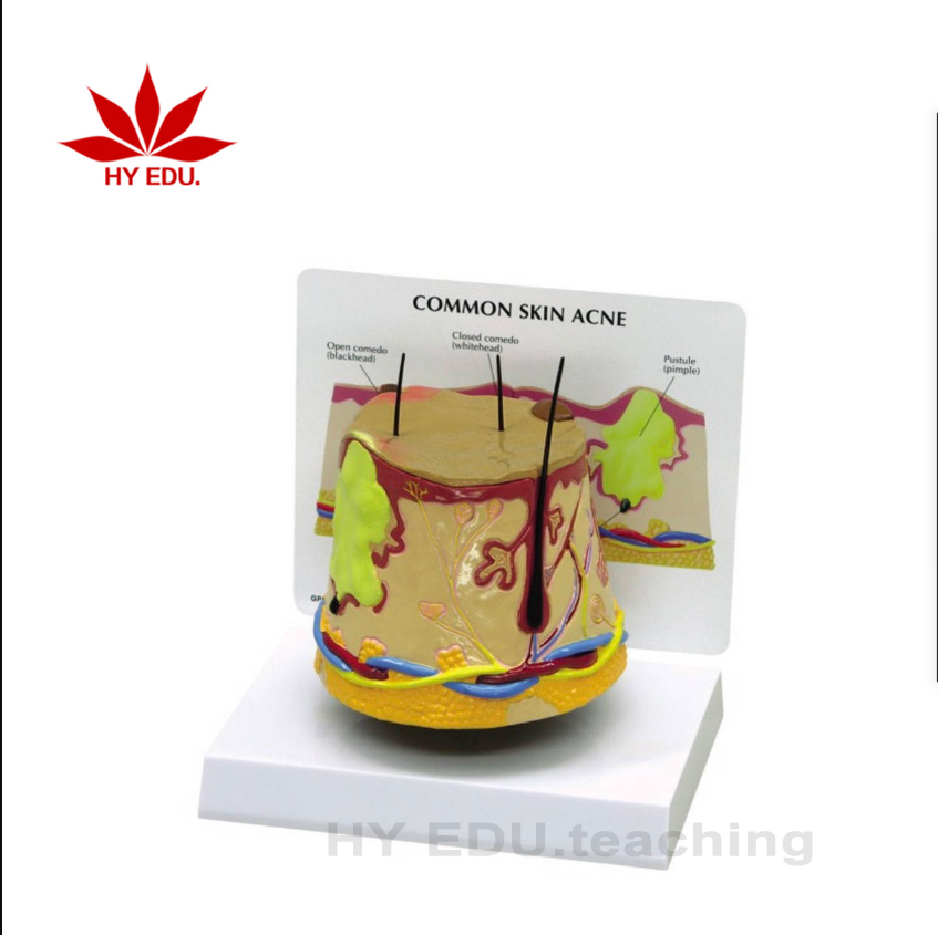 Медицинская научная модель для биологии, модель анатомической ткани для кожи от акне