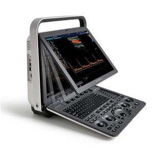 Système d'échographie vétérinaire professionnel Sonoscape S8 ExpV pour des soins hospitaliers complets aux animaux - Product Image 3