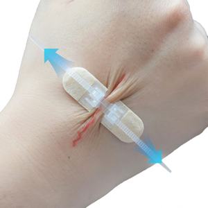 Dispositif de fermeture de plaies stérile jetable médical adhésif 1,2 cm x 5,8 cm, bande de fermeture de plaies, dispositif de fermeture de plaies - Product Image 4