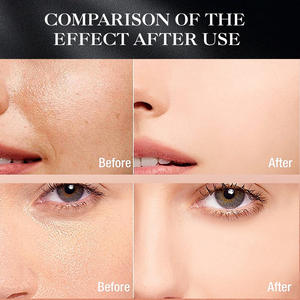 Lotion personnalisée anti-rides, éclaircissante, réparatrice, au rétinol, à la vitamine C, au collagène et au curcuma, pour tous types de peaux, 100 ml - Product Image 3