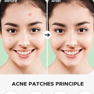 Venta caliente 36 piezas hidrocoloide Invisible acné parche fuente de fábrica personalizado antiarrugas corrector ligero fino al por mayor acné - Product Image 6