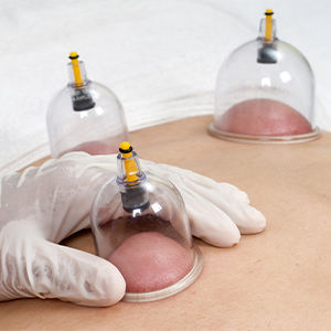 伝統的な中国医学18個セット真空カッピングセットプラスチック製ヒジャマカッピングセット - Product Image 4