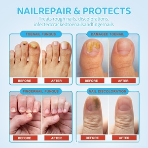 Reparatur-Creme Kräuter-Straffungscreme Hypoallergen Gegen Verfärbungen und Brüchige Nägel Lindert Juckreiz und Brennen Stellt Gesundheit Wieder Her OEM 20g - Product Image 4