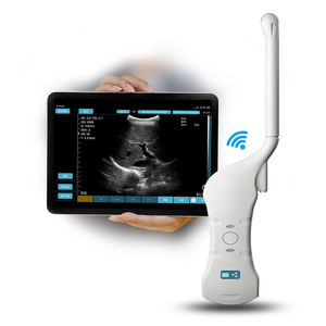 Machine à ultrasons Doppler couleur sans fil couleur portable et efficace à 128 éléments de convexe et transvaginale - Product Image 4