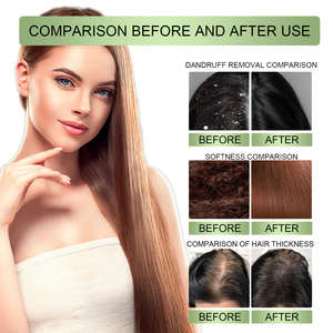 NESANDA bitkisel organik çay ağacı yağı saç büyüme anti-saç dökülmesi saç derisi tedavisi anti-kepek besleyici hızlı yeniden büyüme - Product Image 4