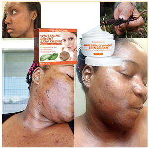 Crema facial efectiva <span class=keywords><strong>para</strong></span> blanquear manchas oscuras, pigmento alivia pecas, Corrector de <span class=keywords><strong>Melasma</strong></span>, belleza de la piel, OEM - Product Image 1
