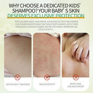 Productos OEM seguros <span class=keywords><strong>para</strong></span> el cuidado de <span class=keywords><strong>la</strong></span> piel y el <span class=keywords><strong>cabello</strong></span> <span class=keywords><strong>para</strong></span> niños, diseñados específicamente <span class=keywords><strong>para</strong></span> el champú suavizante <span class=keywords><strong>para</strong></span> niños - Product Image 3