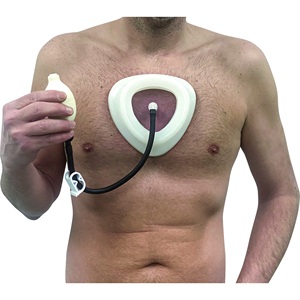Ortesi per Pectus Excavatum, Sistema di Correzione Toracica in Silicone Medicale con Vuoto, Dispositivo di Correzione del Torace S 15cm M 19cm L 21cm - Product Image 1