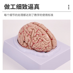 Modèle d'artère cérébrale, modèle d'anatomie du cerveau, modèle de cerveau, modèle de tige cérébrale, modèle de structure du cerveau, neurologie - Product Image 3