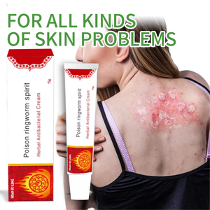 Vente en gros OEM de crème à base de plantes qui soulage rapidement les démangeaisons causées par l'eczéma et le psoriasis - Product Image 2