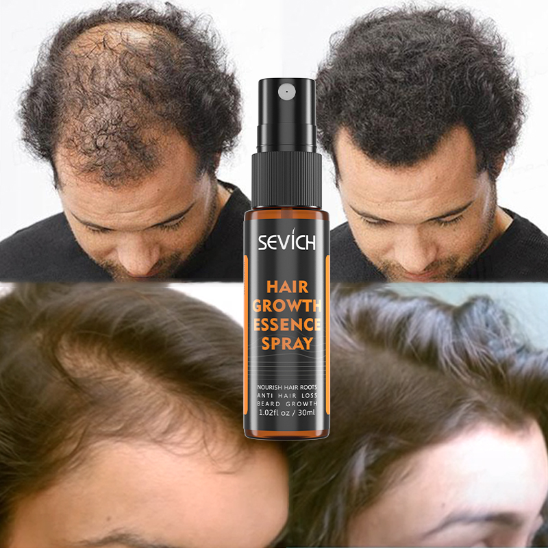 Частная марка, сыворотка для роста волос против выпадения, утолщенный спрей для роста волос