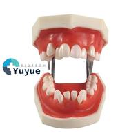 Fil de ligature et cire rouge pour modèle de pratique orthodontique - Outil de formation en compétences dentaires
