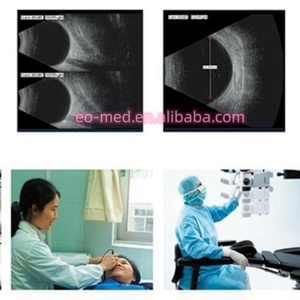 Escáner de Ultrasonido LED Oftálmico A/B EUS500T, Precio de Fábrica, para Pruebas de Biometría Ocular en Oftalmología - Product Image 6