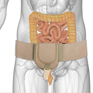 เข็มขัดพยุงไส้เลื่อนข้อสําหรับผู้ชายเหมาะกับโครงสร้างรองรับไส้เลื่อนหลังการผ่าตัดด้านซ้ายหรือขวา - Product Image 5