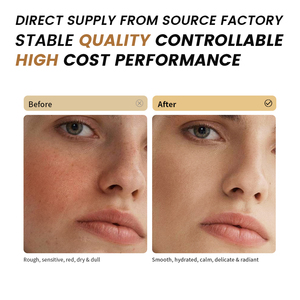 <span class=keywords><strong>Exfoliante</strong></span> Facial OEM <span class=keywords><strong>de</strong></span> Marca Privada OAT, Exfoliación Suave, Aclaramiento, Reparación <span class=keywords><strong>de</strong></span> <span class=keywords><strong>la</strong></span> Barrera Cutánea, Hidratante, Limpieza <span class=keywords><strong>de</strong></span> Poros, <span class=keywords><strong>Para</strong></span> Todo Tipo <span class=keywords><strong>de</strong></span> Piel - Product Image 5