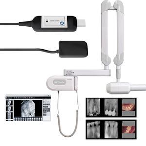 Macchina a raggi X dentale montata a parete digitale Intra-orale a raggi X a parete Carestream di Fashion Design - Product Image 3