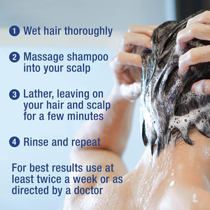 <span class=keywords><strong>Shampoo</strong></span> Antifungino per Psoriasi del <span class=keywords><strong>Cuoio</strong></span> <span class=keywords><strong>Capelluto</strong></span>, Follicolite e <span class=keywords><strong>Dermatite</strong></span> Seborroica, Allevia il Prurito e la Secchezza, 300ml - Product Image 5