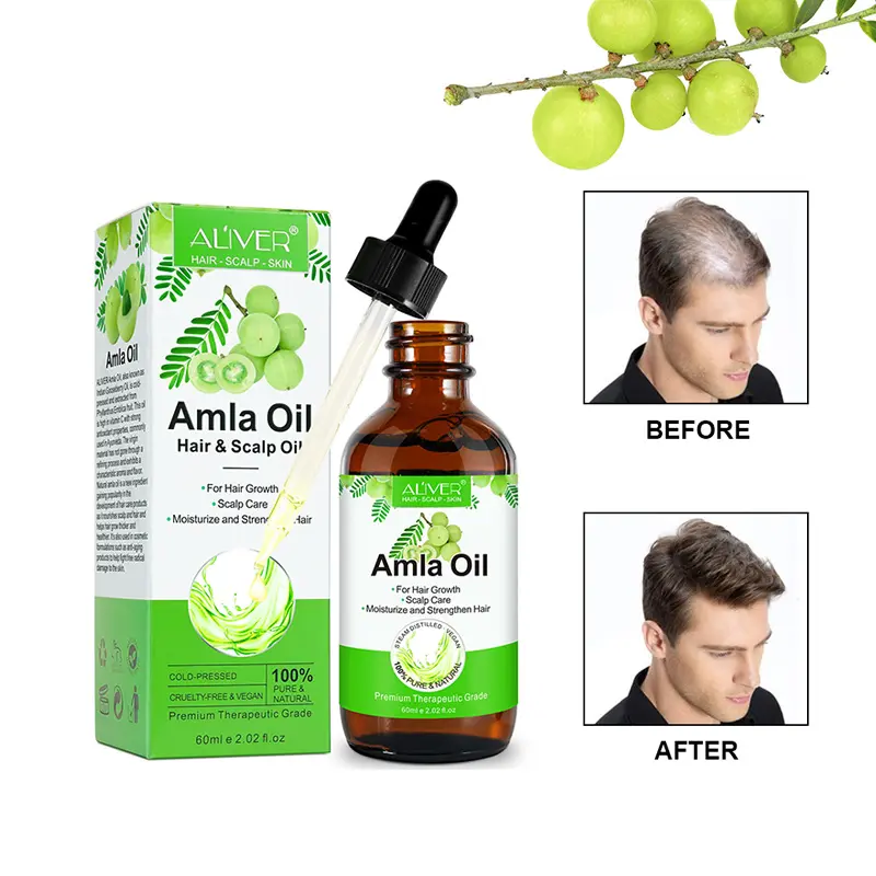 Grosir vendor 60ml minyak Amla India murni gooseberi memperbaiki rambut rusak kering Vegan organik untuk pertumbuhan rambut