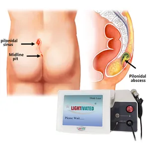 CE医用肛瘘桩激光切割模式类血治疗双1470nm 980nm直肠吸脂手术机