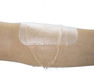 Hidrokolloid yara pansuman Bedsore teşvik yara şifa hidrokolloid tıbbi bant ölçeklenebilir çevre dostu hidrokolloid - Product Image 2