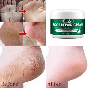 MELAO Best Sellers Crème à l'urée <span class=keywords><strong>pour</strong></span> les <span class=keywords><strong>pieds</strong></span>, soin des <span class=keywords><strong>pieds</strong></span>, crème réparatrice <span class=keywords><strong>pour</strong></span> les <span class=keywords><strong>pieds</strong></span> <span class=keywords><strong>secs</strong></span>, rugueux, épais, fissurés, callosités, crème <span class=keywords><strong>pour</strong></span> les <span class=keywords><strong>pieds</strong></span> à l'urée - Product Image 2