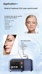 Appareil laser fractionné CO2 portable <span class=keywords><strong>2026</strong></span> pour le resurfaçage cutané, l'élimination des cicatrices d'acné et le resserrement vaginal – Équipement de beauté laser - Product Image 6
