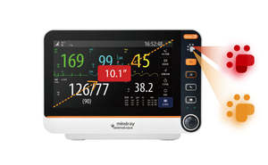 Monitor Veterinario Portátil Mindray Vetal 3, Monitoreo de Signos Vitales Multiparamétrico para Animales - Product Image 5