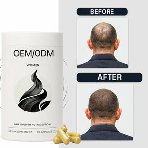 מחיר ישיר מפעל מניות מוכן איזון צמיחת שיער תוספי תזונה צמיחת שיער nutacists biotin - Product Image 2