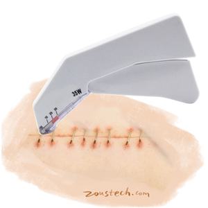Agrafeuse automatique de peau de la <span class=keywords><strong>suture</strong></span> 35W d'instruments chirurgicaux jetables - Product Image 1