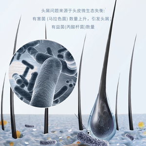 Beotua 300ml dầu gội tóc <span class=keywords><strong>Selenium</strong></span> disulfide gàu cứu trợ làm mịn nuôi dưỡng làm mới giữ ẩm làm sạch đặc tính - Product Image 3