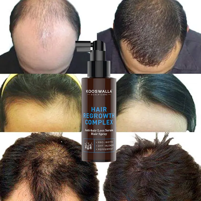 OEM ODM частная марка 100% травяная натуральная формула оптом против выпадения волос и роста волос спрей