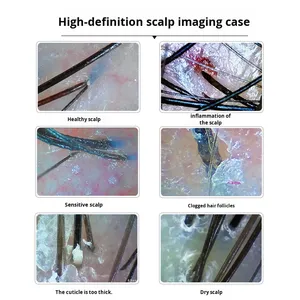 Detector de Cuero Cabelludo Botin, Analizador de Folículos Pilosos, Analizador de Piel, Dispositivo de Fotocaptura, Terapia Capilar, Uso en Salón de Belleza, 1 Año, 220V, IP67 - Product Image 4