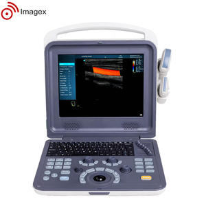 凸面と線形プローブを備えたポータブルカラードプラー超音波 - Product Image 5