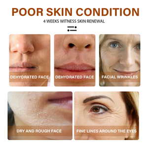 EELHOE Anti-invecchiamento del viso siero di vitamina C e acido ialuronico con retinolo ordinario idratante siero viso capsula di gesso cinese - Product Image 3