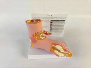 Modè<span class=keywords><strong>le</strong></span> de pied pathologique en PVC de marque Yulin pour la communication avec <span class=keywords><strong>les</strong></span> patients, pour la goutte, <span class=keywords><strong>les</strong></span> complications, l'arthrite, l'articulation du pied <span class=keywords><strong>et</strong></span> de la cheville - Product Image 4