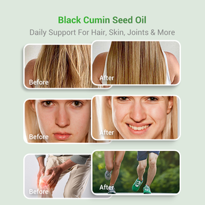 <span class=keywords><strong>Olio</strong></span> di <span class=keywords><strong>cumino</strong></span> nero naturale, - Product Image 3