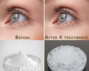 אבקת חומצה היאלורונית כיתה אבקת חומצה היאלורונית עם משקל מולקולרי גבוה ונמוך אבקת חומצה היאלורונית - Product Image 3