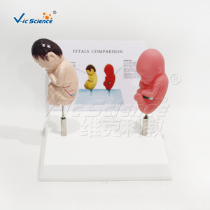 Modèle comparatif de fœtus sain en position couchée sur le ventre ; affichage des différences de développement fœtal ; outil éducatif pour - Product Image 2