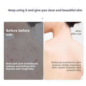 Alfombrilla de silicona con fuerte succión para masaje de espalda, antideslizante, herramienta de frotamiento de espalda, ventosa potente, sencilla para masaje de pies - Product Image 2