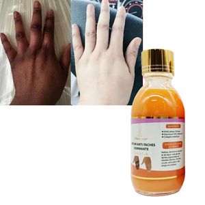 Removedor de nudillos oscuros, suero blanqueador, aceite brillante para nudillos de manos, suero Facial corporal para manchas oscuras, suero blanqueador de piel para piel negra - Product Image 1