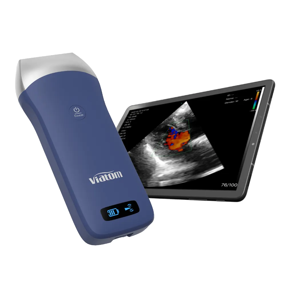 Viatom 128 elemanları kablosuz ultrason doğrusal prob 7.5/10MHz el ultrason taşınabilir