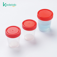 Plástico estéril de hospital desechable 50ml 30ml muestra taburete contenedor de orina